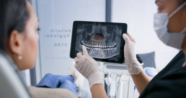 Licensed Tooth Extraction service in Castro Valley, CA - Smile Center Dentistry